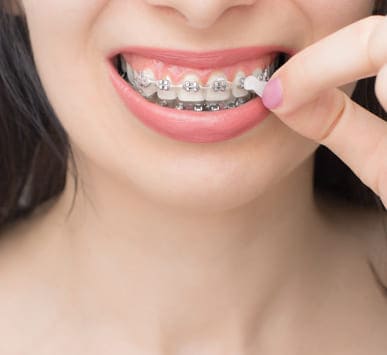 Orthodontic Treatment