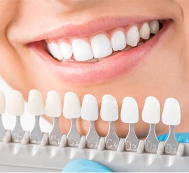 Tooth-Coloured Fillings