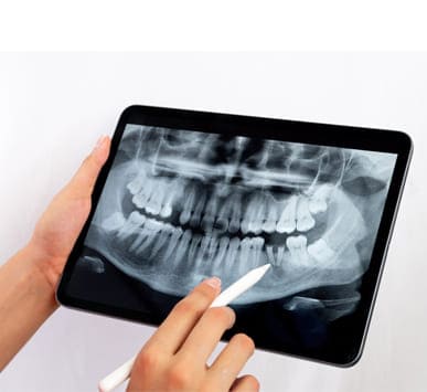 Dental X-ray